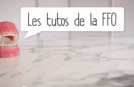 disjoncteur palatine suivi orthodontique Nos Conseils nivet