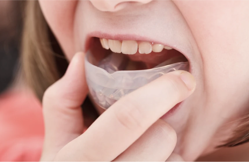 orthodontie fonctionnelle posture Plaque palatine nivet