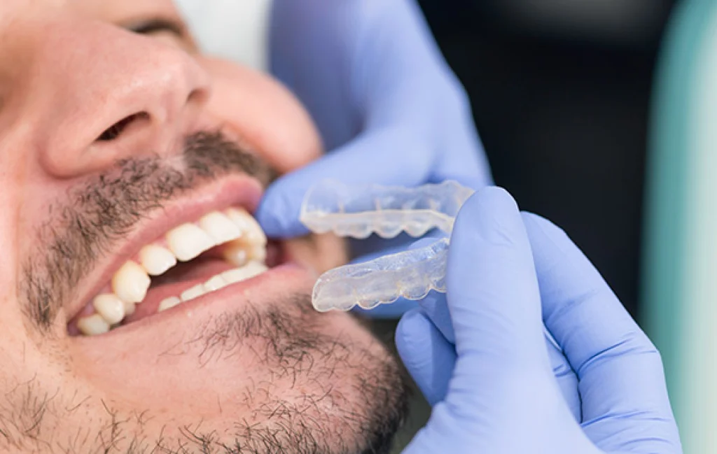 orthodontiste la roche sur yon soins adultes orthodontiste la roche sur yon soins adultes L'orthodontie invisible Orthodontistes à La Roche-sur-Yon | Cabinet 7SMILE