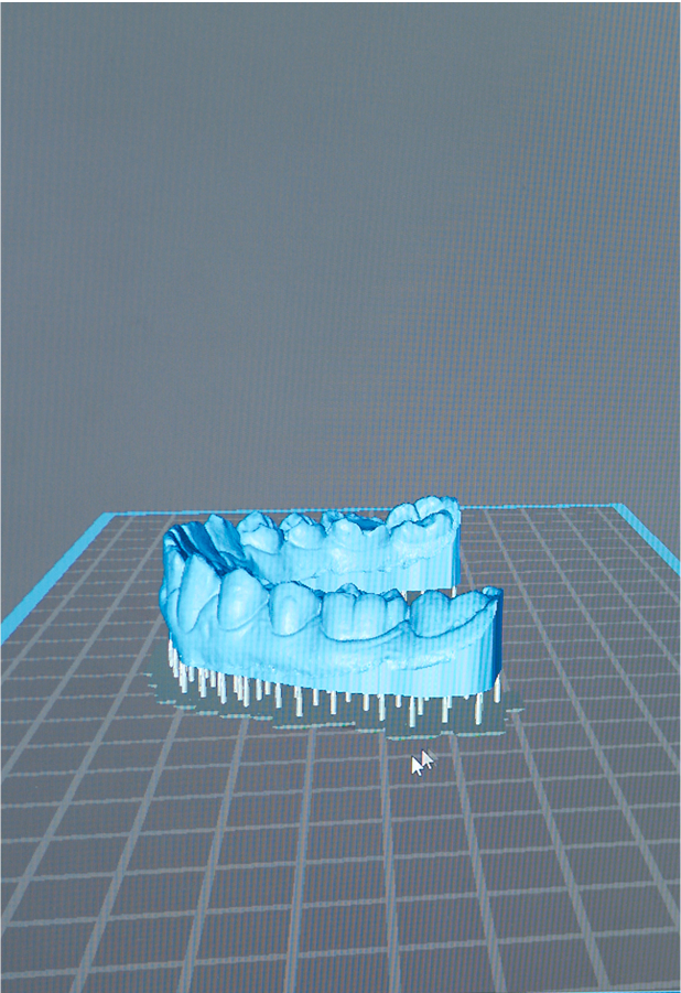 orthodontie fonctionnelle equilibre facial Accueil nivet